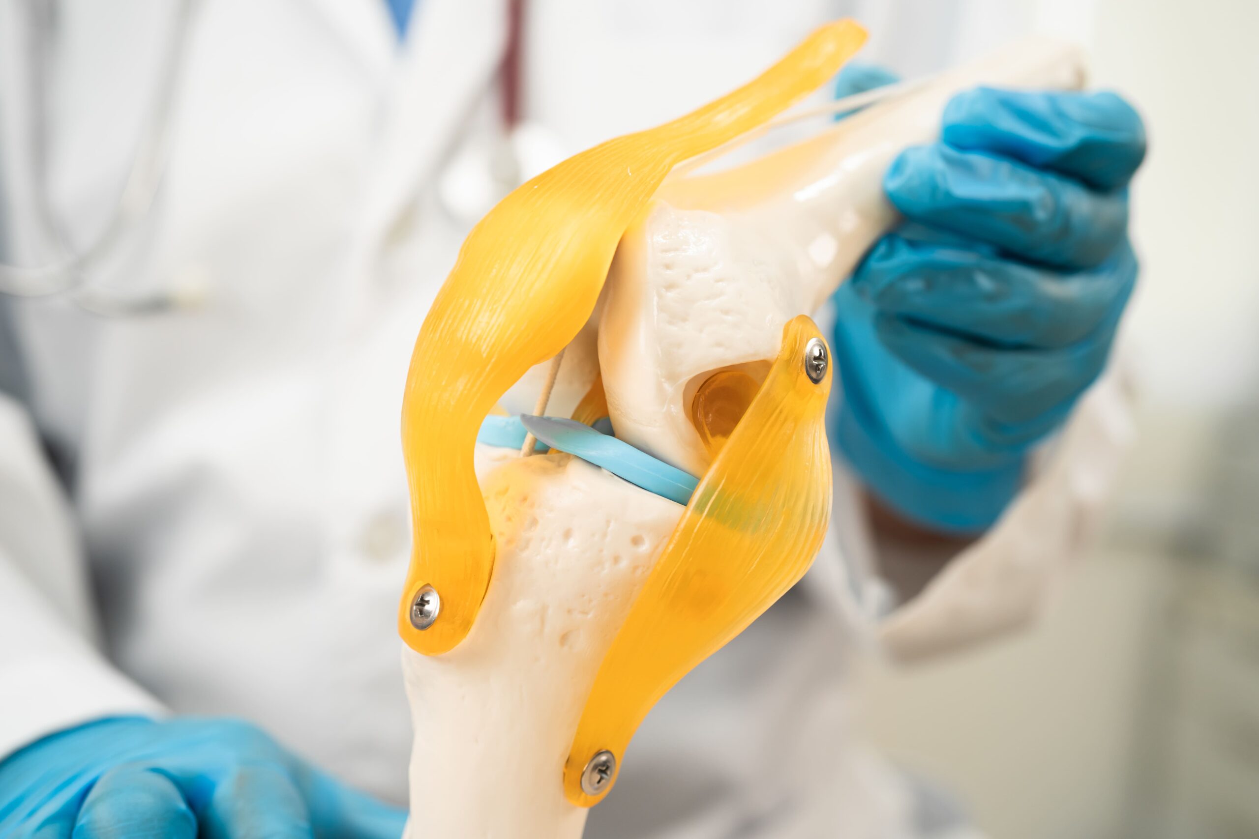 Choosing Your Orthopaedic Surgeon for Partial Knee Replacement in ...