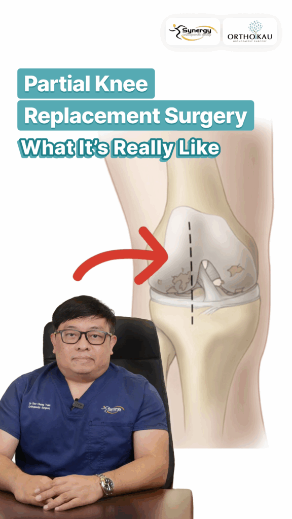 Total Knee Replacement Surgery In Singapore | By Dr Kau Chung Yuan